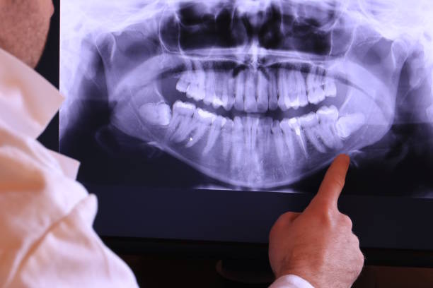 Best Emergency Treatment for Oral Infections in Salem, MO